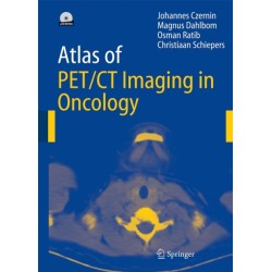 Atlas of PET/CT Imaging in Oncology