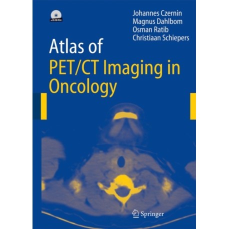 Atlas of PET/CT Imaging in Oncology
