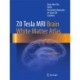 7.0 Tesla MRI Brain White Matter Atlas