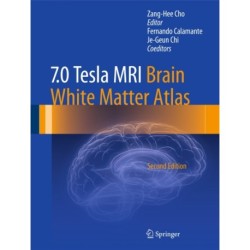 7.0 Tesla MRI Brain White Matter Atlas