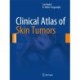 Clinical Atlas of Skin Tumors