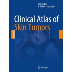 Clinical Atlas of Skin Tumors