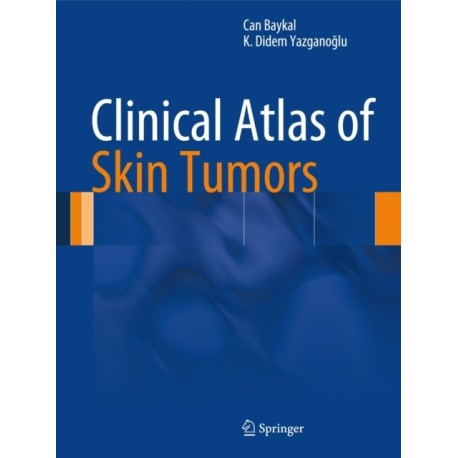 Clinical Atlas of Skin Tumors
