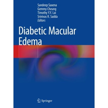 Diabetic Macular Edema