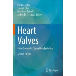 Heart Valves: From Design to Clinical Implantation
