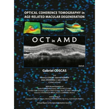 Optical Coherence Tomography in Age-Related Macular Degeneration