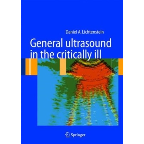 General ultrasound in the critically ill
