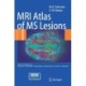 MRI Atlas of MS Lesions