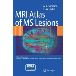 MRI Atlas of MS Lesions