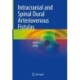 Intracranial and Spinal Dural Arteriovenous Fistulas