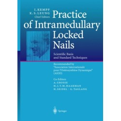 Practice of Intramedullary Locked Nails: Scientific Basis and Standard Techniques Recommended “Association Internationale pour I’Osteosynthese Dynamique” (AIOD)