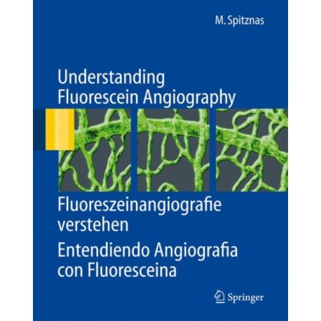Understanding Fluorescein Angiography, Fluoreszeinangiografie verstehen, Entendiendo Angiografia con Fluoresceina: Fluoreszeinangiografie Verstehen, Entendiendo Angiografia Con Fluoresceina