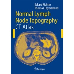 Normal Lymph Node Topography: CT Atlas