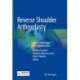 Reverse Shoulder Arthroplasty: Current Techniques and Complications