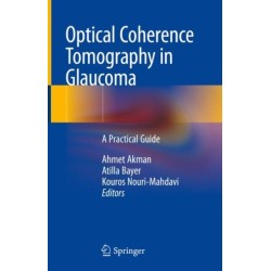 Optical Coherence Tomography in Glaucoma: A Practical Guide