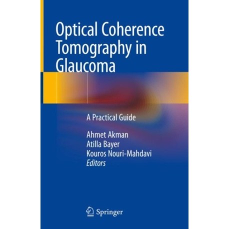 Optical Coherence Tomography in Glaucoma: A Practical Guide