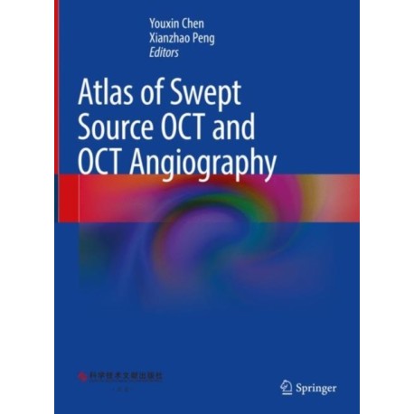 Atlas of Swept Source OCT and OCT Angiography