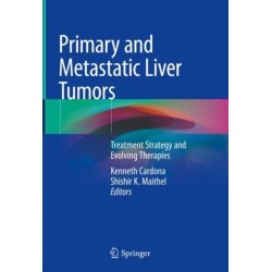 Primary and Metastatic Liver Tumors: Treatment Strategy and Evolving Therapies