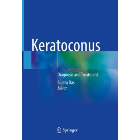 Keratoconus: Diagnosis and Treatment