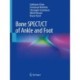 Bone SPECT/CT of Ankle and Foot
