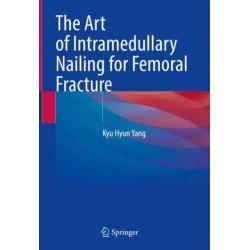 The Art of Intramedullary Nailing for Femoral Fracture