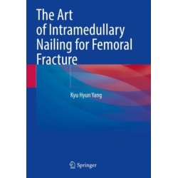 The Art of Intramedullary Nailing for Femoral Fracture