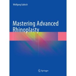 Mastering Advanced Rhinoplasty