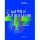 CT and MRI of Skull Base Lesions: A Diagnostic Guide