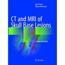 CT and MRI of Skull Base Lesions: A Diagnostic Guide