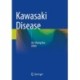 Kawasaki Disease