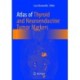Atlas of Thyroid and Neuroendocrine Tumor Markers