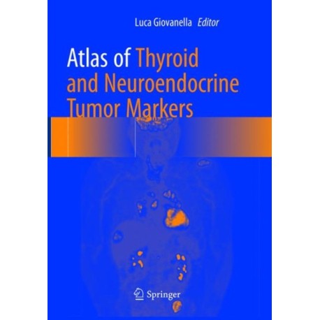 Atlas of Thyroid and Neuroendocrine Tumor Markers