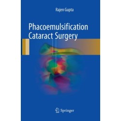 Phacoemulsification Cataract Surgery