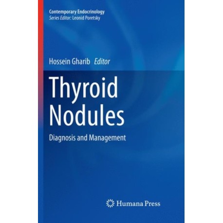Thyroid Nodules: Diagnosis and Management
