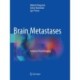 Brain Metastases: Advanced Neuroimaging