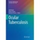 Ocular Tuberculosis