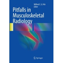 Pitfalls in Musculoskeletal Radiology