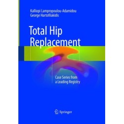 Total Hip Replacement: Case Series from a Leading Registry
