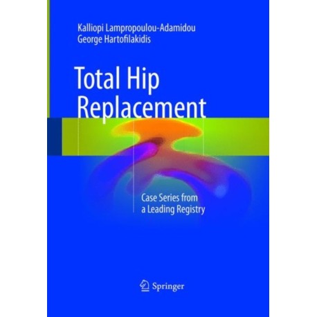 Total Hip Replacement: Case Series from a Leading Registry