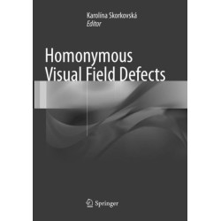 Homonymous Visual Field Defects