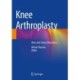 Knee Arthroplasty: New and Future Directions