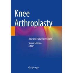 Knee Arthroplasty: New and Future Directions