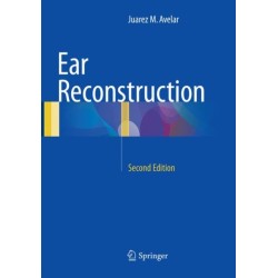 Ear Reconstruction