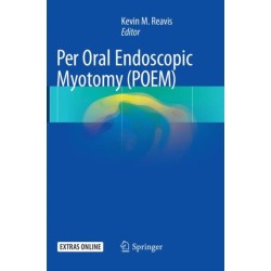 Per Oral Endoscopic Myotomy (POEM)