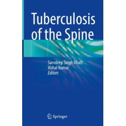 Tuberculosis of the Spine