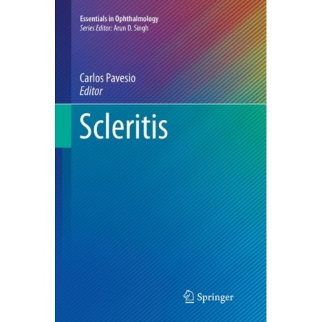 Scleritis