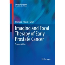 Imaging and Focal Therapy of Early Prostate Cancer