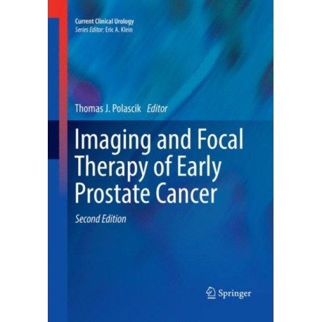 Imaging and Focal Therapy of Early Prostate Cancer