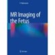 MR Imaging of the Fetus