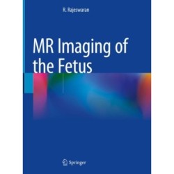 MR Imaging of the Fetus
